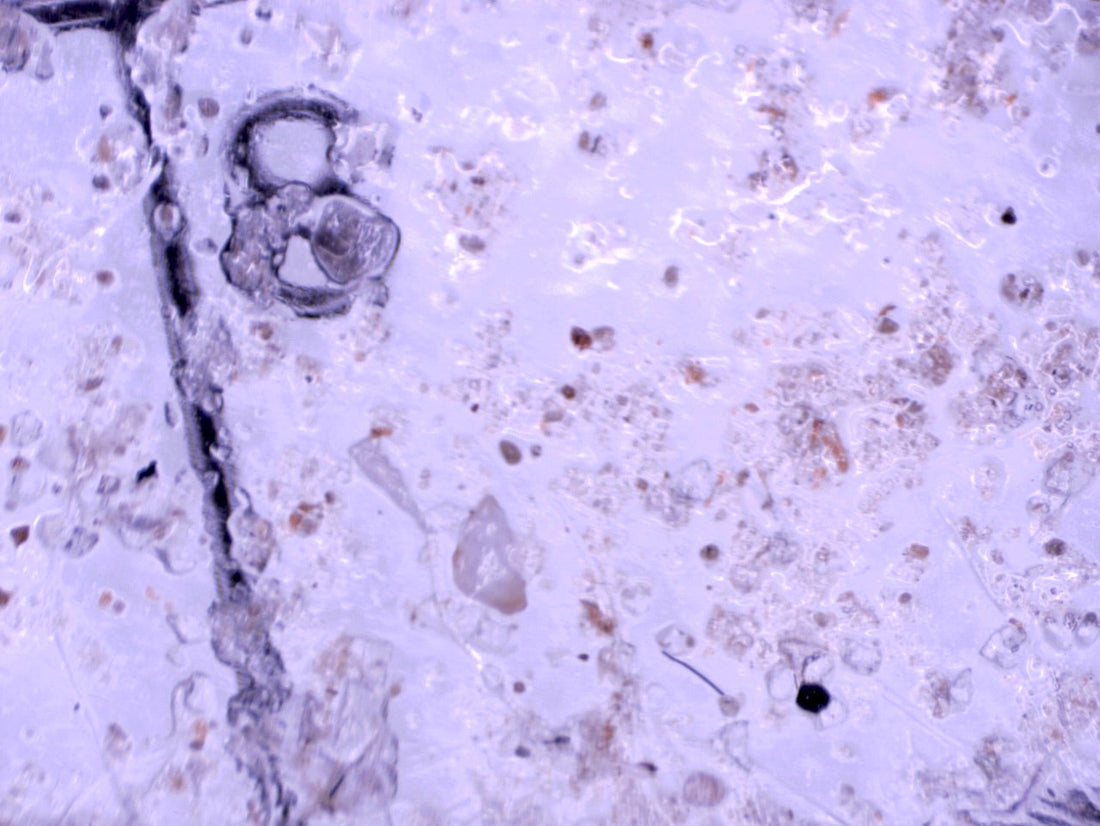 What Are Microplastics?