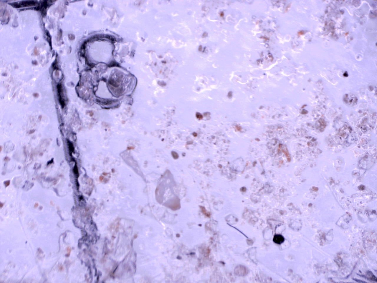 What Are Microplastics?
